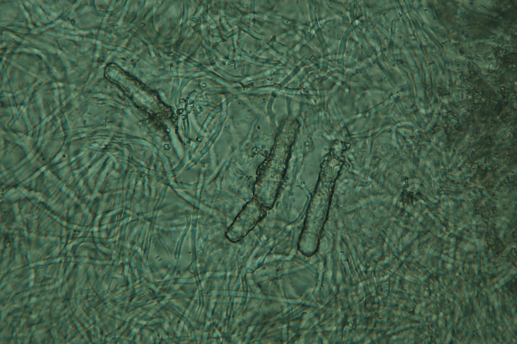 ForseSteccherinum straminellum-f3409(Steccherinum ochraceum)